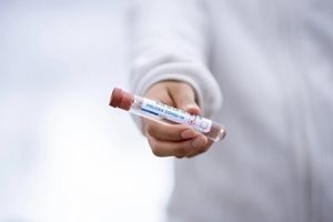 28 са вече заразените с лептосироза в Сараево